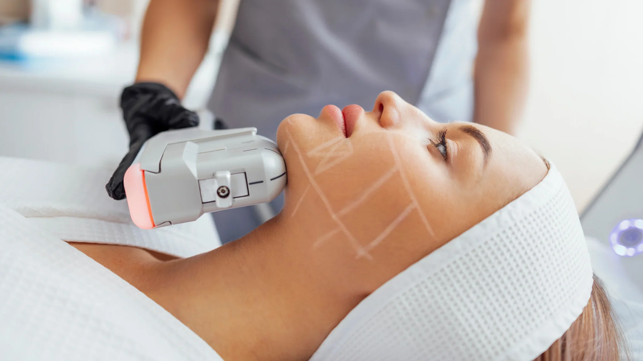 HIFU Facial Guayaquil