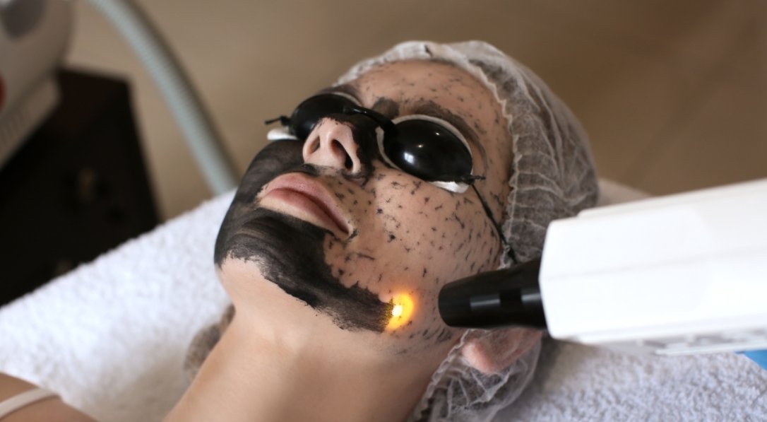 Hollywood Peel Guayaquil – Thai Beauty Center Spa